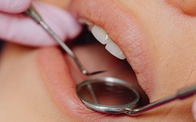 Vue rapprochée du contrôle dentaire d'un patient à l'aide d'un miroir et d'outils dentaires.