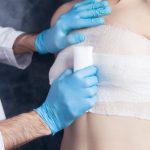 clinique de liposuccion